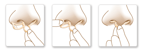 Diagram of inserting a Breathe Aid